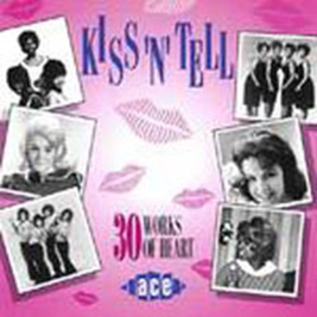 Kiss 'N' Tell