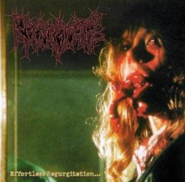 Effortless Regurgitation