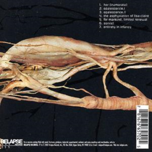 Transfer Trachea Reverberations From Point: False Omniscient