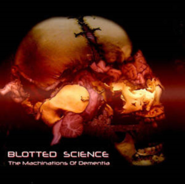 The Machinations of Dementia