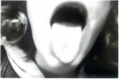 Pronoun