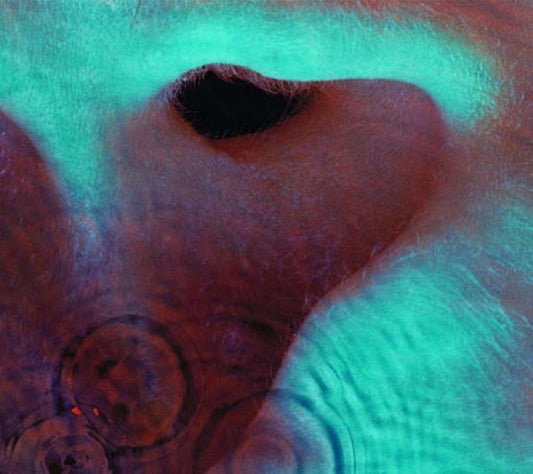 Meddle