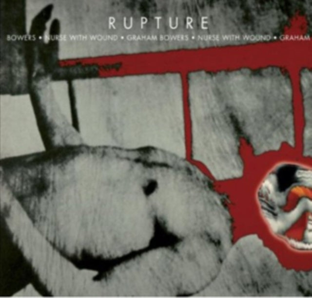 Rupture