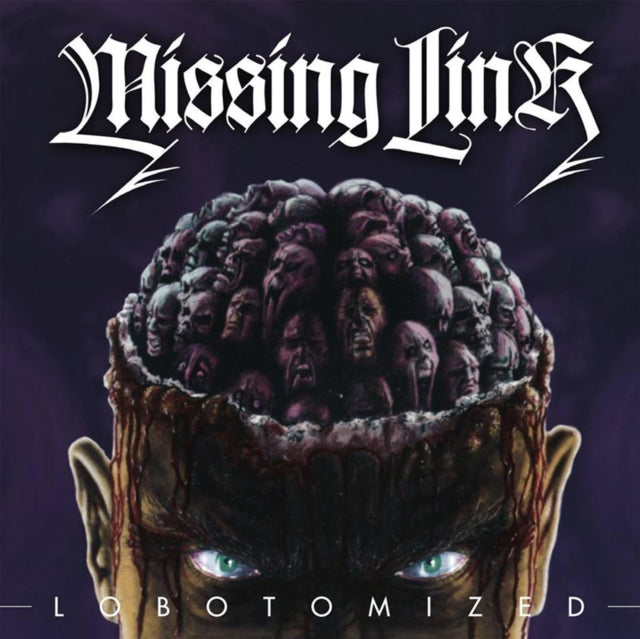 Lobotomized
